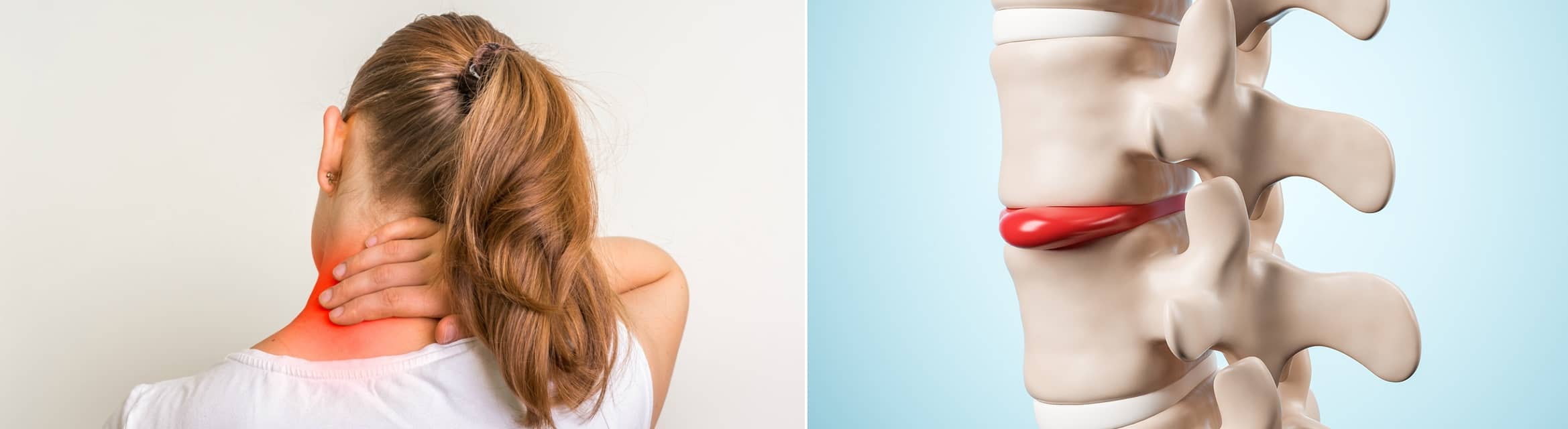 Лечение позвоночной грыжи